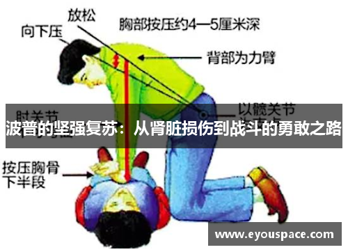 波普的坚强复苏：从肾脏损伤到战斗的勇敢之路
